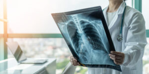 Pulmonary Hypertesnion scan